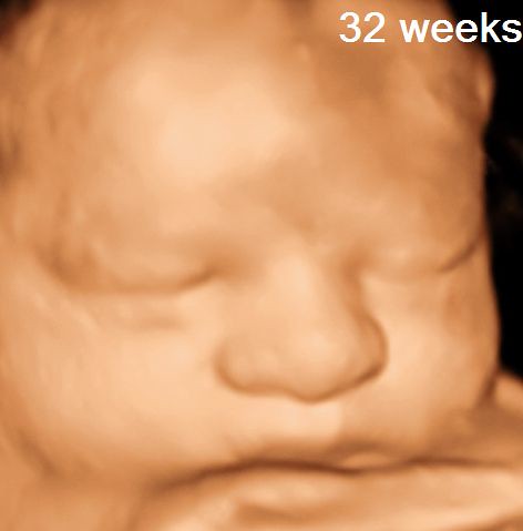 3d ultrasound pictures at 26 weeks. 3D Ultrasound -Baby 32 WEEKS
