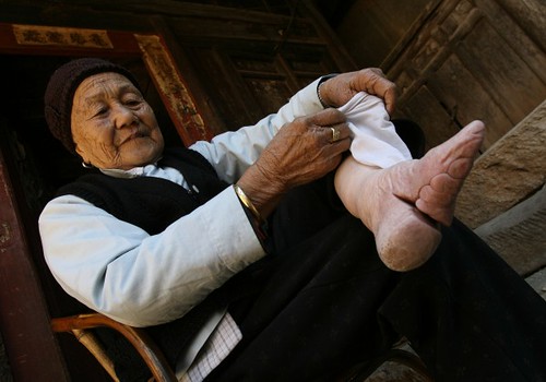 Villages in China where women with bound feet survive are increasingly rare