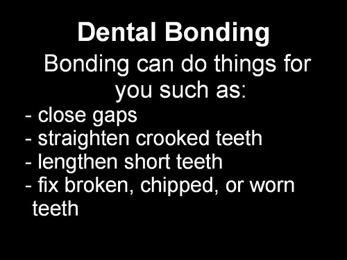 Dental Bonding 2