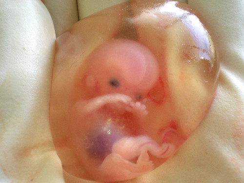 10-Week Fetus