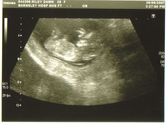 baby-12wk-scan