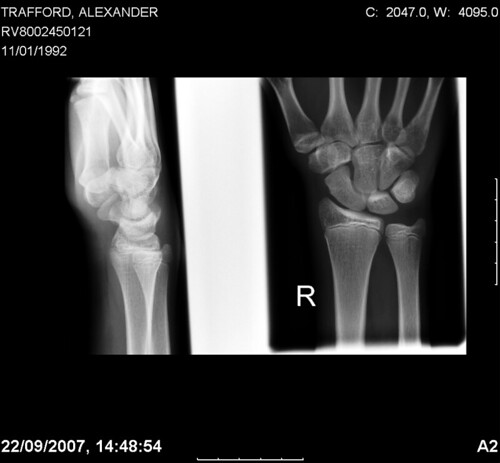 x ray hand. X-Ray Right Hand