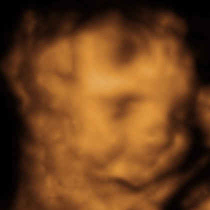 3d ultrasound pictures at 26 weeks. Mara and I had a 3D ultrasound