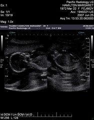 20070625k notnooboo ultrasound