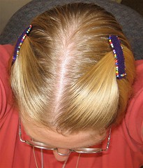 Top View of Barrettes