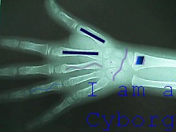 I am a cyborg