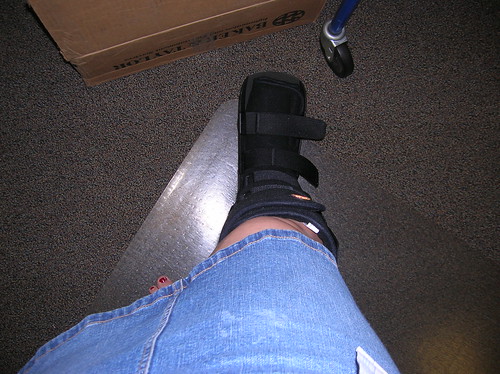 Broken foot!
