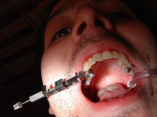 Reparación dental por comer golosinas