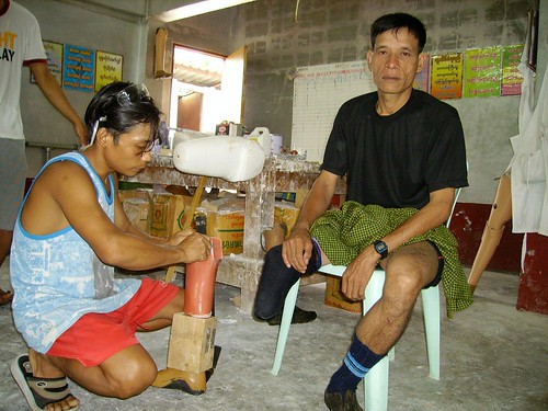 fitting a landmine survivor in the mae sot clinic