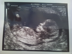 baby number 2