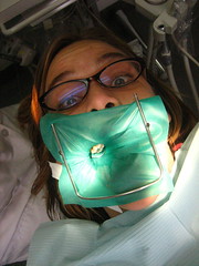 photo of an open-mouthed dentist's patient.