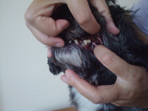 Dentes após limpeza do tártaro