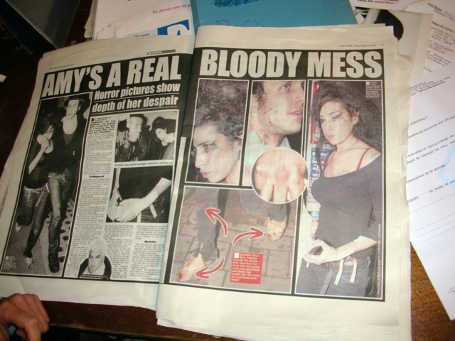 Amy Winehouse bloody mess