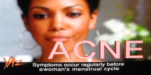Yaz birth control pill ad screen grab (acne)