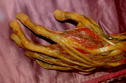 tendons in hand. Wax Hand, Tendons and Veins