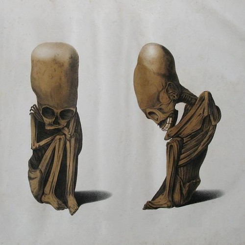 Odd Peruvian skeletons