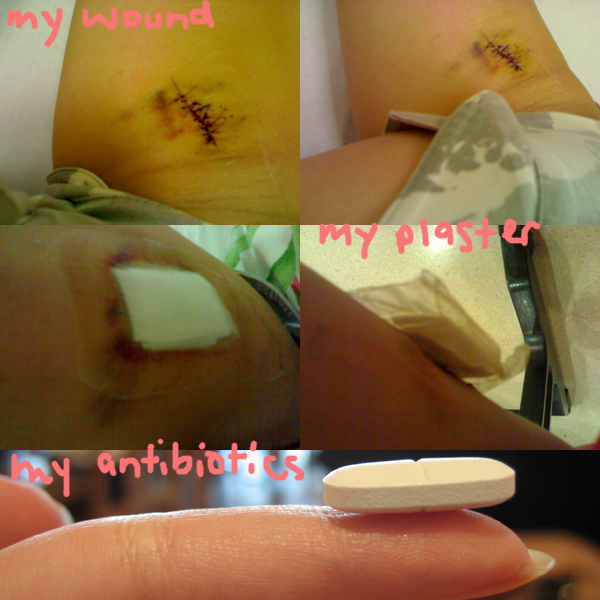 my wound