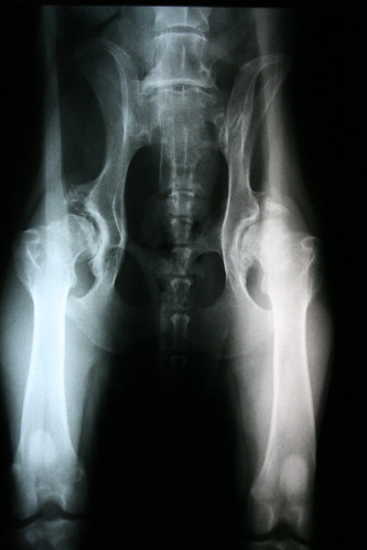 Arthritis - Radiograph