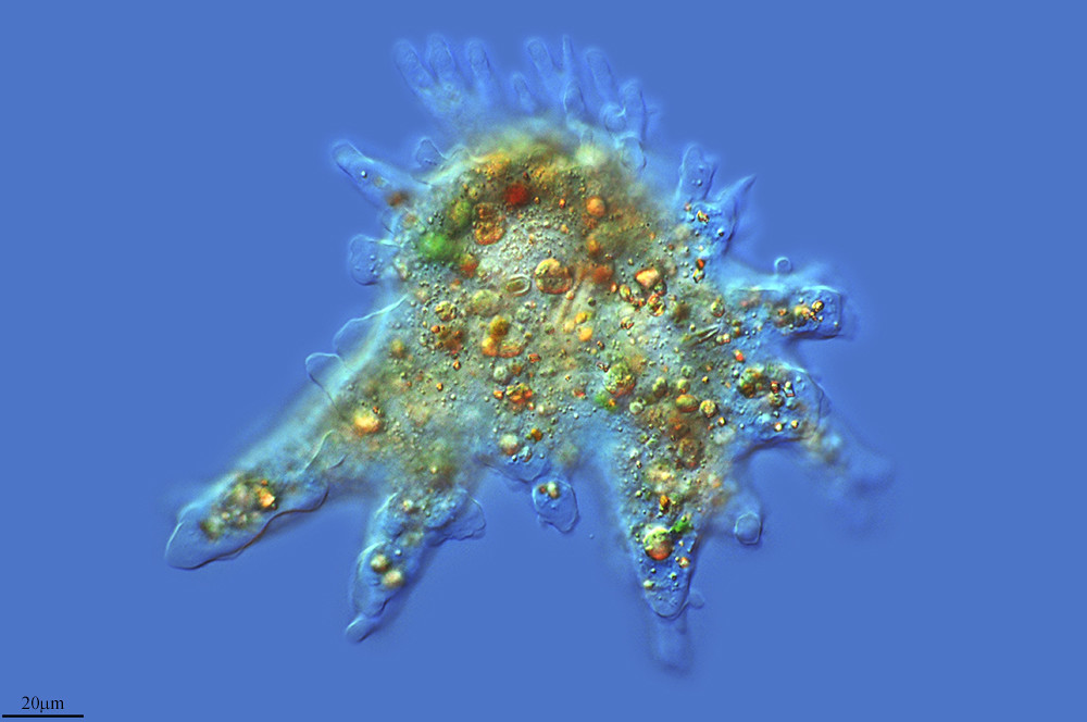 Znalezione obrazy dla zapytania ameba