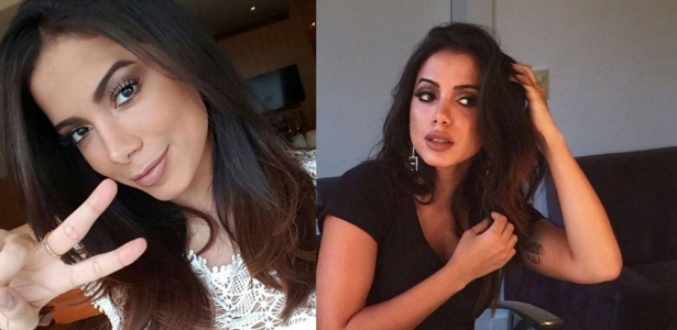 Anitta aparece com lábios mais grossos e internautas desconfiam de botox
